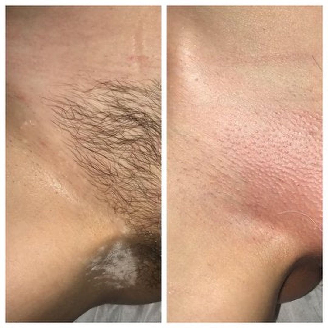 Waxing service at MK Permanent Makeup