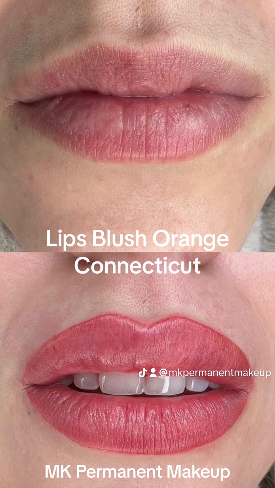 Lip blush collage — MK Permanent Makeup