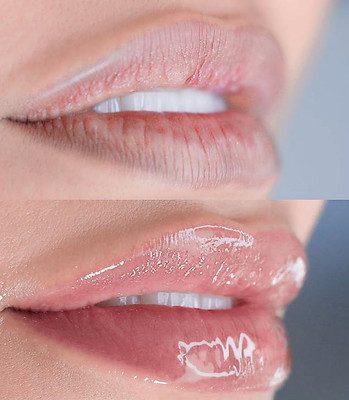 Lip blush — before and after