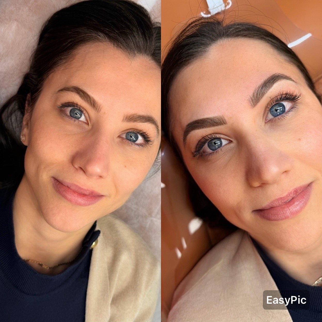 Brow transformation — before and after