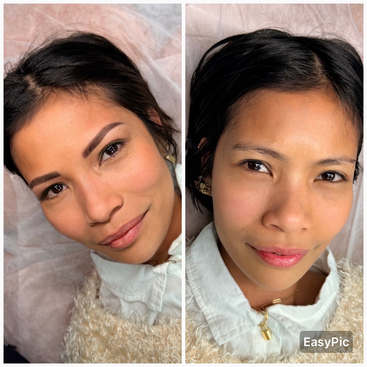 Brow result — before and after