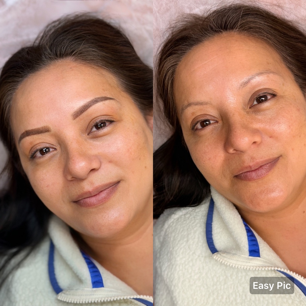 Brow result — before and after