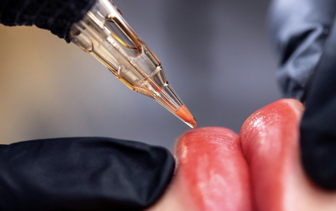 Lip blush procedure in progress