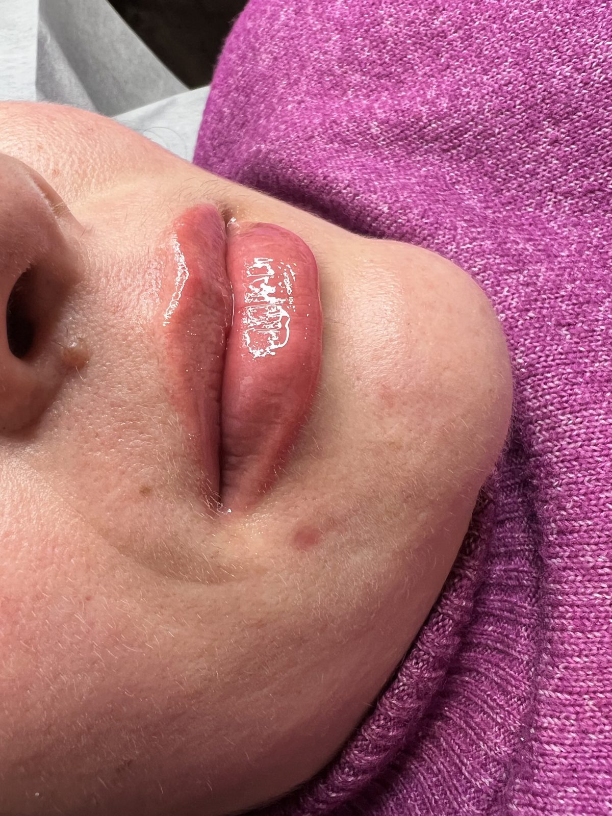 Fresh lip blush result