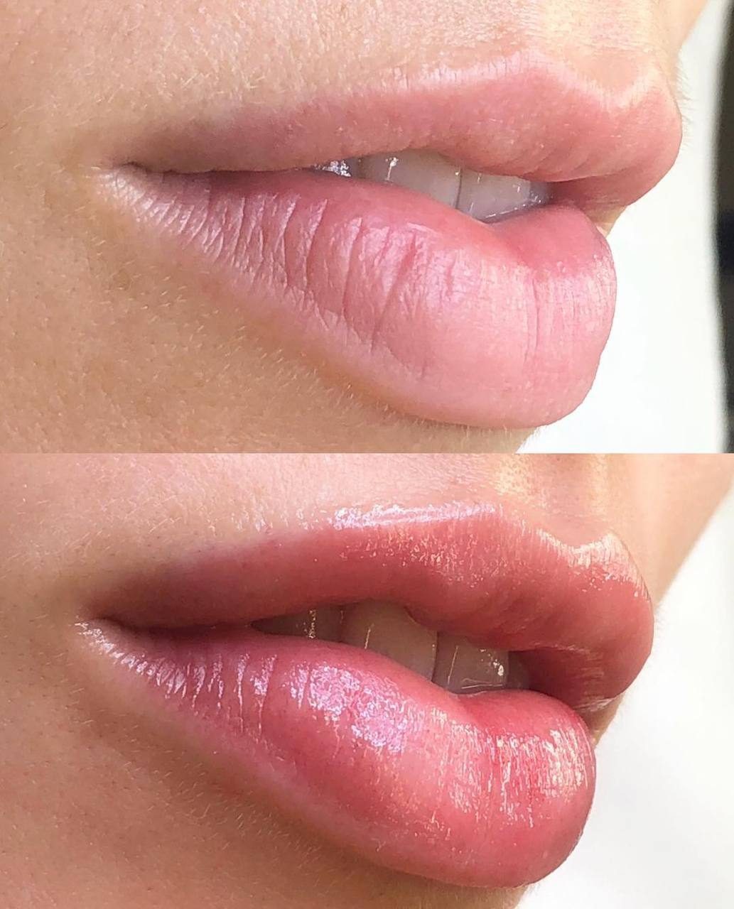 Lip blush — before and after